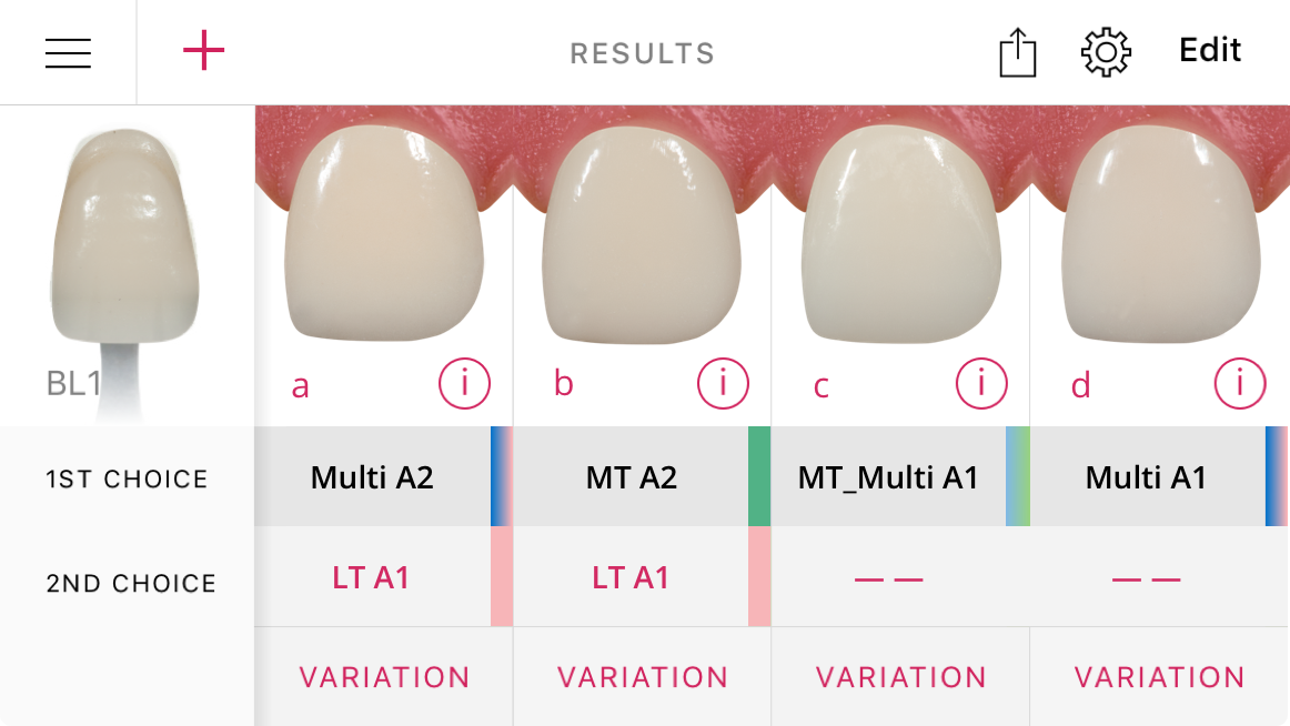 Ivoclar Vivadent Shade Navigation App User Interface