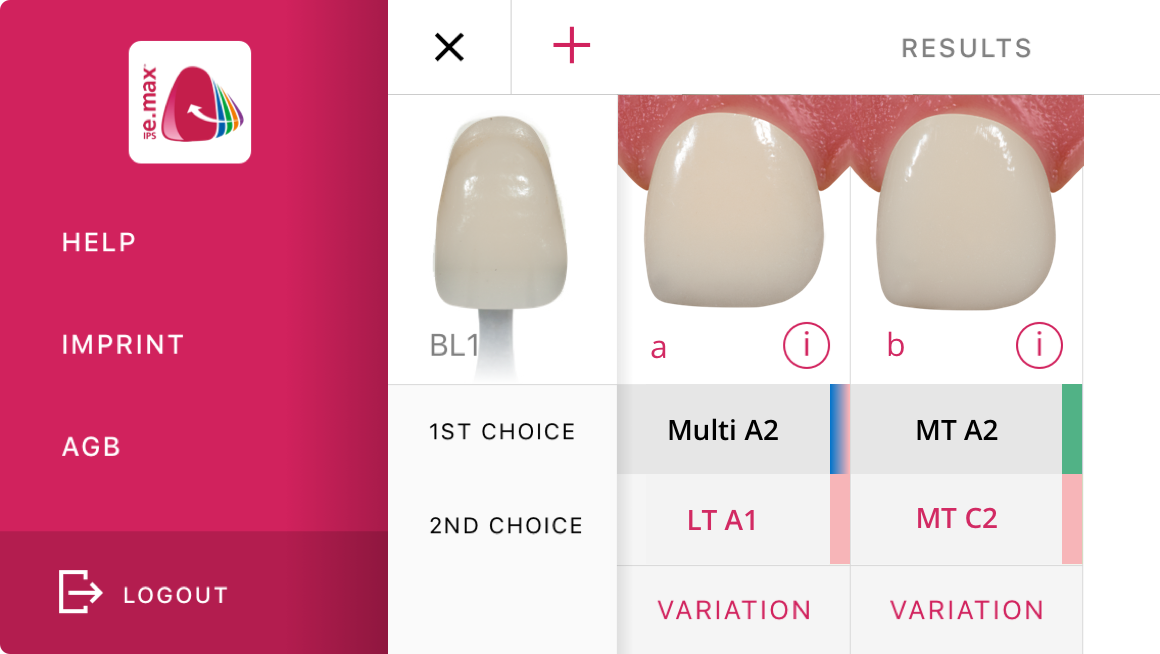 Ivoclar Vivadent Shade Navigation App User Interface